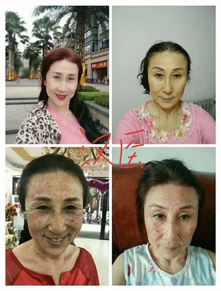 純中藥?kù)畎叽砑用苏猩? title=